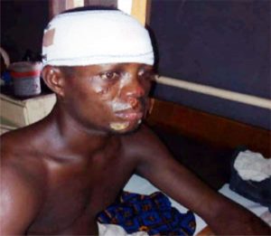 Herdsmen attack victim